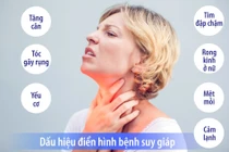 Nữ giới suy giáp cao gấp 8 lần nam giới, dấu hiệu cảnh báo