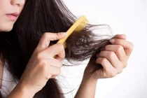 Kích thích huyệt phục hồi tóc rụng sau sốt xuất huyết