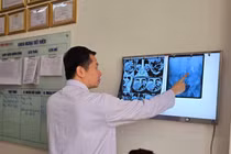 Chủ quan sỏi thận không đau, không điều trị, người bệnh bị suy thận nặng