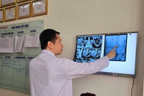 Chủ quan sỏi thận không đau, không điều trị, người bệnh bị suy thận nặng