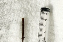 Uống thuốc lá tự sắc, người đàn ông bị thủng dạ dày do mảnh cây