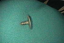 Bé trai 2 tuổi nuốt ốc vít sắc nhọn vào bụng