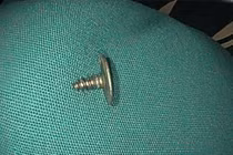 Bé trai 2 tuổi nuốt ốc vít sắc nhọn vào bụng