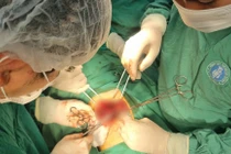 Bé hơn 2 tuổi ngồi sau xe máy ngã vỡ gan nguy kịch