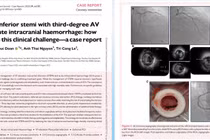 Ca bệnh hiếm gặp ở Việt Nam được đăng trên tạp chí châu Âu