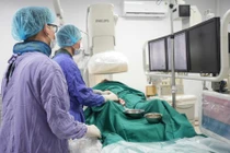 Người đàn ông 60 tuổi bị nhồi máu não lồi thể trai hiếm gặp