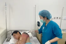 Đừng để 'mẹo dân gian' biến chấn thương nhẹ thành nhiễm trùng nặng