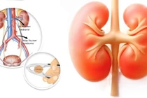 Đi khám vì sụt cân, bé trai được phát hiện Hội chứng kẹp hạt dẻ