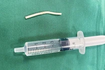 Nhập viện do que tránh thai đi vào cơ bắp