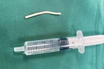 Nhập viện do que tránh thai đi vào cơ bắp