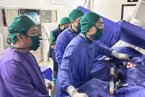 Đặt stent cứu cụ ông 66 tuổi đau bụng do phình động mạch chủ bụng