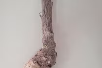 2 người ngộ độc, phản vệ vì chữa bệnh bằng cây dân gian