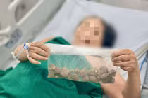 Dùng củ ấu tàu chữa xương khớp, cụ bà ngộ độc nguy kịch