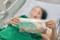 Dùng củ ấu tàu chữa xương khớp, cụ bà ngộ độc nguy kịch