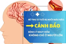 Đang khỏe mạnh, bé trai 13 tuổi đột ngột nhồi máu não