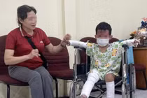 Chữa bỏng cho bé trai duy nhất sống sót trong vụ cháy nhà tại An Khê, Gia Lai