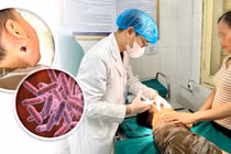Bé 4 tuổi bị vi khuẩn ăn thịt người tấn công nguy kịch
