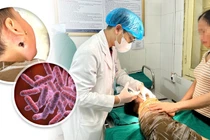 Bé 4 tuổi bị vi khuẩn ăn thịt người tấn công nguy kịch