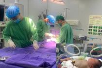 Mổ cứu thai nhi 2 ngày tuổi mắc bệnh lý hiếm ống rốn tràng