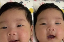 Giữ thai thành công thêm 12 tuần để mẹ sinh con an toàn