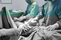 Loại bỏ khối u xơ tử cung "tương đương thai 4 tháng"