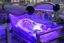 Cuộc chiến cam go cứu bộ não cho trẻ 30 giờ tuổi