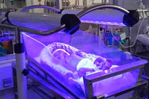 Cuộc chiến cam go cứu bộ não cho trẻ 30 giờ tuổi