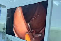 Trực đêm chống bão WIPHA, cứu ca sốc mất máu cấp nguy kịch