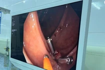 Trực đêm chống bão WIPHA, cứu ca sốc mất máu cấp nguy kịch