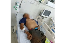 Người đàn ông hôn mê sâu, xuất huyết dạ dày... nguy kịch do ăn bọ xít