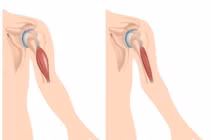 Con trai mắc bệnh hiếm, người mẹ bất ngờ phát hiện mang gen bệnh nguy hiểm