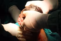 10 phút căng thẳng trong đêm cứu hai mẹ con sản phụ nguy kịch