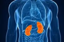 Gần 2000 ca ung thư thận mới mỗi năm, đừng để “cái bẫy thầm lặng” dình dập