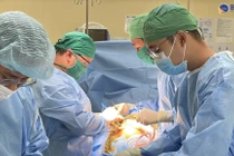 38 tuổi phải thay khớp háng vì hoại tử chỏm xương đùi