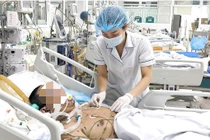 Lây thủy đậu từ con gái, người đàn ông 36 tuổi nguy kịch vì viêm phổi ARDS