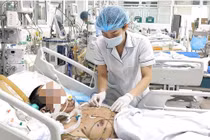 Lây thủy đậu từ con gái, người đàn ông 36 tuổi nguy kịch vì viêm phổi ARDS