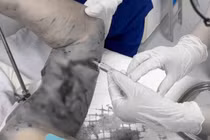 Chó becgie nặng hơn 30 kg tấn công chủ 72 tuổi gây tổn thương nghiêm trọng