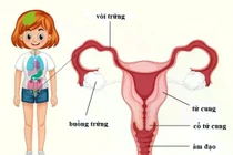 Chơi đùa té ngã, bé 12 tuổi tổn thương nghiêm trọng vùng kín