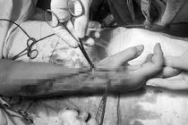 Dựng cây nêu đón Tết hai vợ chồng ở Nghệ An bị điện giật nghiêm trọng