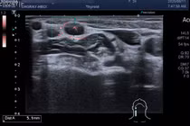 Loại ung thư có tỷ lệ mắc cao nhất ở nữ giới khi đi khám