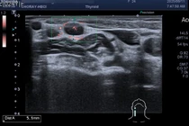 Loại ung thư có tỷ lệ mắc cao nhất ở nữ giới khi đi khám