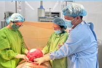Đợi u biến mất, cuối cùng phải cắt bỏ u xơ tử cung nặng 4,5 kg