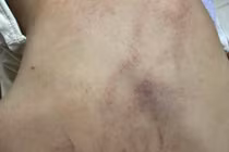 Bộ Y tế thông tin vụ nghi trẻ 4 tuổi bị bạo hành