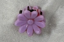 Bé gái 8 tuổi nôn nhiều, không ngờ kẹp tóc trong âm đạo 