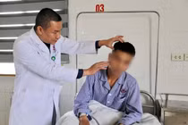 Chàng trai 29 tuổi mang dị vật đầu bút, lò xo gãy suốt 13 năm tại thái dương