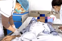 Mờ mắt đột ngột không ngờ giang mai thần kinh thể viêm màng não