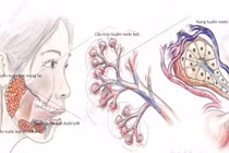 Địa chỉ vàng: Bệnh viện điều trị u tuyến nước bọt