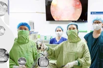 Nữ sinh 25 tuổi đau bụng không ngờ tử cung đôi kèm bất sản thận trái