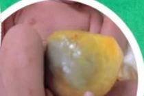 Sàng lọc trước sinh quyết định hành trình an toàn của mẹ và bé