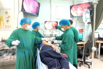 Cắt tách niêm mạc dạ dày qua nội soi, tránh ung thư 